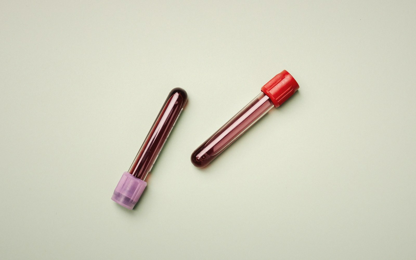 Two blood sample tubes with purple and red caps lying on a pale surface