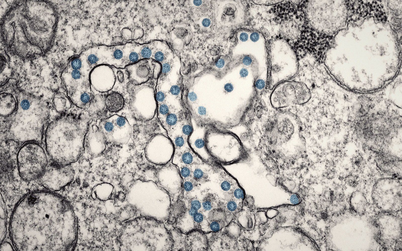 Electron micrograph showing virus particles highlighted in blue within infected cell tissue