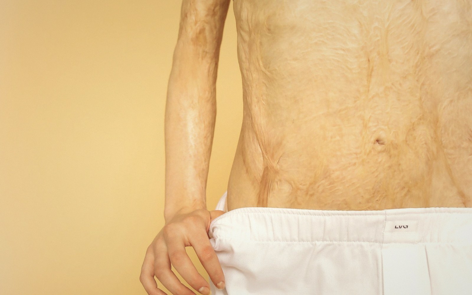 Bare torso with deeply wrinkled skin, hand tucked into waistband of white shorts