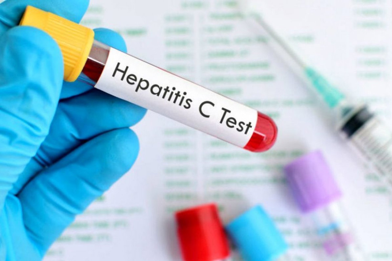 Hepatitis C Virus: Why You Should Get Tested